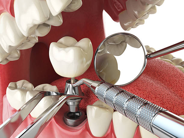Best Emergency Treatment for Dental Infections or Abscesses in Mount Holly, NC